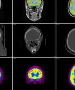 Neuroimagem Multimodal - Curry - Imagem 8