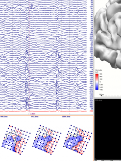 Alternative view of Neuroimagem Multimodal - Curry