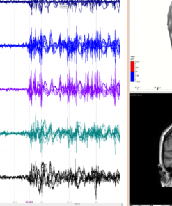 Neuroimagem Multimodal - Curry - Imagem 3