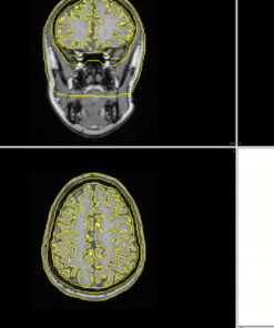 Neuroimagem Multimodal - Curry - Imagem 9