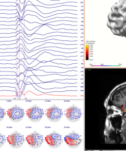 Neuroimagem Multimodal - Curry - Imagem 4