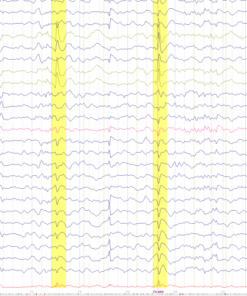 Neuroimagem Multimodal - Curry - Imagem 5