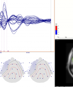 Neuroimagem Multimodal - Curry - Imagem 6