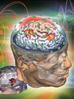 Neuroimagem Multimodal