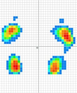 PhysioSensing